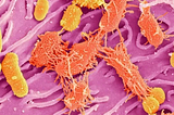 Example of mixed oral bacteria (https://irp.nih.gov/our-research/accelerating-science/zooming-in-on-the-microbiome).