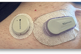 Continuous Glucose Monitors: Does Better Accuracy Mean Better Glycemic Control?