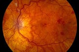 Learn About Common Eye Disorders And Diseases With Dr. Zuhal Butuner