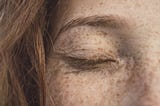 The Story of How My Freckles Returned