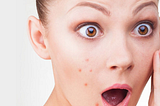 If you wake up to see your worst Nightmare… A face full of Pimples!
