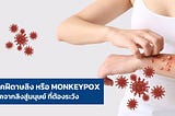 โรคฝีดาษลิง หรือ Monkeypox โรคจากลิงสู่มนุษย์ ที่ต้องระวัง