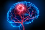 An Introduction to Brain Tumors and Craniotomy Procedures