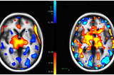 Contrasting radiotracer & non-invasive neuroimaging techniques for regional CBF measurement