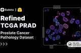 Refined TCGA PRAD