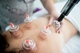 Benefits of Hijama/Wet Cupping Points No: 14, 15, 16, 17, 18.