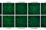 Alternatives to Fetal Bovine Serum in Cultivating Cultured Meat