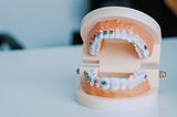 The Basics of Orthodontics: What You Need to Know