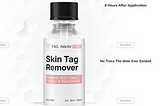 Tag Away Pro Skin Tag Remover Official Website, Working, Price In USA & Reviews [Updated 2024]