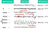 An image showing three basic sleep stages (N1,N2,N3) and their corresponding EEG brain wave patterns.