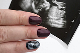 TRENDING: Ultrasound nails