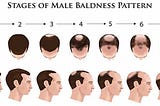 Effective Treatments for Male Pattern Baldness in 2024
