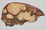 The Vital Role of the Pancreas and Vitamins in Human Health