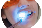 Laser teeth whitening in Bangalore| Laser Dentistry — Beyond Smiles Dental Clinic