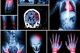 Comprehensive Guide to Free Radiology CE Credits and Professional Certification