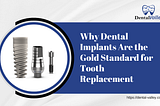 Why Dental Implants Are the Gold Standard for Tooth Replacement