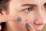 15 Most Common Skin Conditions And Best Treatment Options