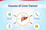 These lifestyle factors increase liver cancer risk