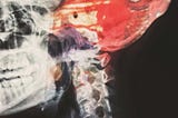 x-ray of a skull with a red monster inside