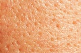 Myths About Open Pores That One Needs To Stop Believing