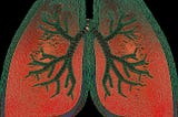 The connection between back torment and cellular breakdown in the lungs