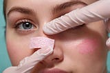 Pore-Strips-1
