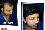 hair extensions for men