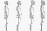 Posture and Neck pain. Are they truly related to each other ?