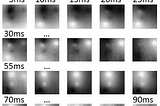 Deep Learning in Ultrasound Images