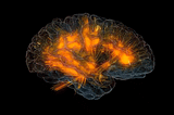 Exploring Brain Architecture: Structural vs Functional Neuroimaging