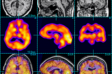 Why Image Processing?