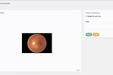 Training a no-code object detector for fundus eye images
