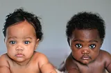 10 RAREST BLACK TWINS WHO ARE ONE IN A MILLION