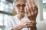 Arthritis Triggers- What to Do With the Treatment Plan?