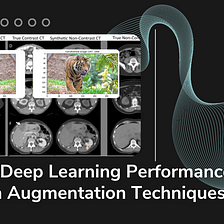 Boosting Deep Learning Performance with Data Augmentation Techniques