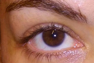 Make Your Eyes More Beautiful With Laser