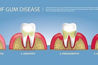 How Do I Kill Gum Disease?