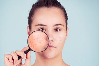 Acne and Blackhead Treatments and Prevention