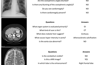 Vision Langauge Models (VLM) in Medicine: A Review