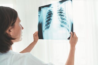 The Use of Chest CT Scans to Diagnose Lung Disorders and Diseases