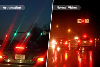 Astigmatism — Know It All!