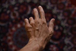 My Scars Are My Resume