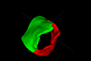 Simplifying 3D Medical Imaging with MONAI Auto3DSeg