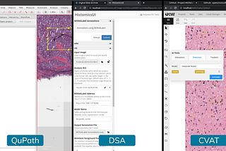 Pathology Image Labeling Comes to MONAI