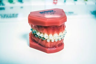 Traditional Braces vs. Modern Options