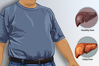A vector image of a healthy liver and a fatty liver.