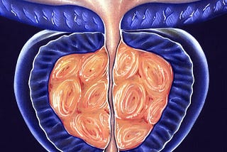 Quoi consommer pour votre prostate ?