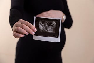 A photo of a pregnant woman holding a photo of her fetal ultrasound.