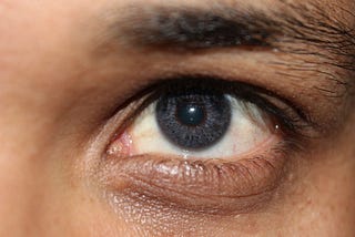 Get all the right data on Laser Eye Color Change Surgery