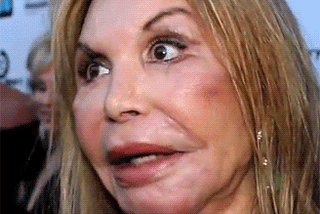 A crazy little thing called BOTOX!